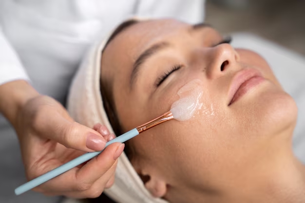 chemical peel