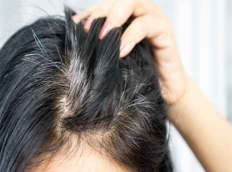 ayurvedic oli for white hair