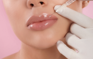 lip fillers in gurgaon
