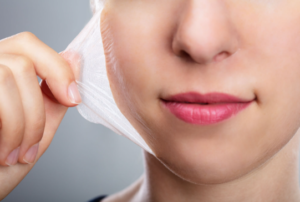 chemical peel treatment in Delhi