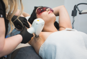 laser hair removal cost in delhi ncr